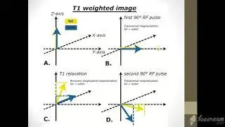 MRI Physics  Part 4 T1 ,T2 and PD اساسيات فيزياء  الرنين المغناظيسي بالعربي