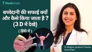 बच्चेदानी की सफाई कब, क्यों और कैसे किया जाता है ?? (3 D में देखे) || हिंदी में || Dr Megha Chadha