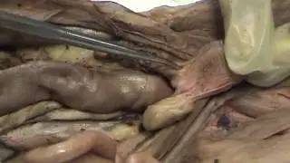 Urinary System