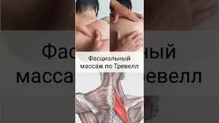 Travell Fascial Massage / Trigger Point Therapy / Pain Between Shoulder Blades / 