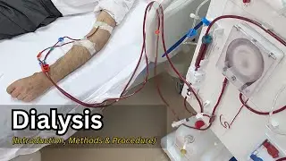 What is Dialysis, Hemodialysis vs. Peritoneal Dialysis