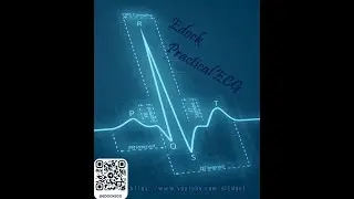 Алгоритм анализа ЭКГ - анализ комплекса QRS и зубца Т.