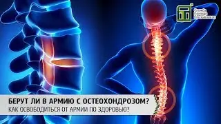 Берут ли в армию с остеохондрозом | Как освободиться от армии с остеохондрозом?