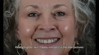 Meet Dana | Bio-CARE Signature Treatment