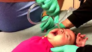 Baby deep nasal suction