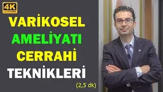 #VARİKOSEL