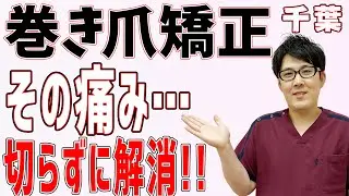 【巻き爪 矯正】化膿したり、歩くのも大変な巻き爪の痛み…切らずに矯正できるのを知っていますか？（実際矯正を受けた方の感想＆実際の施術風景）