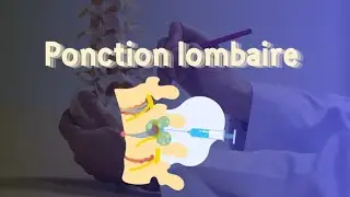 La ponction lombaire 2(La partie pratique)