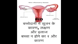 PID INFECTION CAUSES, SYMPTOMS AND TREATMENT