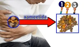 xamiitida dhag-xaanta ku sameeysma adiga ayaa u sabab ah hadii aaa u....see...more.....
