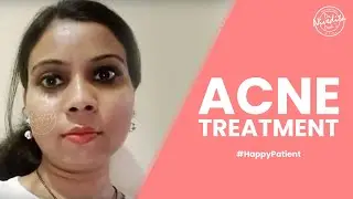 Patient Testimonial | Happy Patients | Acne Treatment | Acne Scars Treatment