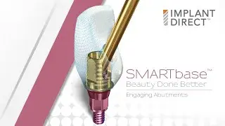SMARTbase™ Engaging Ti-Base Abutment System - Beauty Done Better from Implant Direct