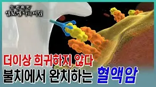 한국 남성 10대암에 들 정도로 더이상 희귀암이 아닌 혈액암. 거듭된 재발에 맞서 싸우는 환자들과 계속 진화하는 첨단 치료법  (KBS 20230510 방송)