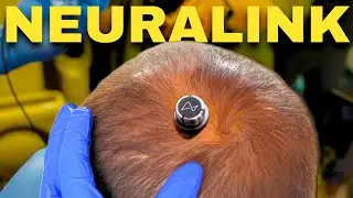 Neuralink's Leap Forward: Connecting Minds to Machines