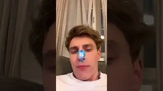 НОЛИК НАПАЛ НА КОМАНДУ А4