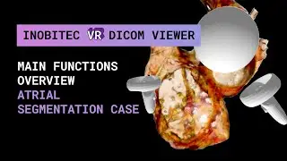 Inobitec VR DICOM Viewer functionality overview. Atrial segmentation case.