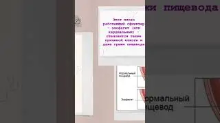 Отрыжка и изжога почему возникают ?