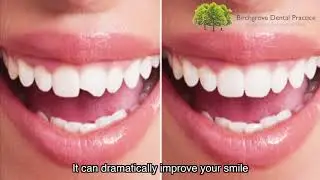 Cosmetic Bonding - Birchgrove Dental Practice