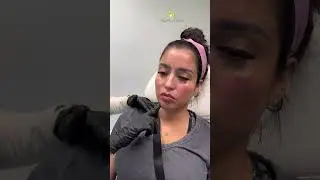 Nefertiti NeckLift