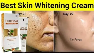 चेहरा को गोरा कर देता है| Best skin lightening cream| pigmentation| dark spot| open pores |