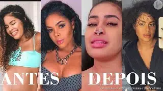 sthefane matos antes e depois da cirurgia no nariz