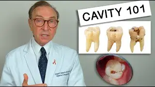 What Causes Tooth Decay? Cavity 101 | Causes | Treatment