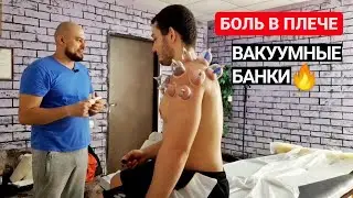 БОЛЬ В ПЛЕЧЕВОМ СУСТАВЕ | СТАВИМ ВАКУУМНЫЕ БАНКИ