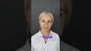 Результат процедуры Fullface