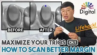 Digital Highlight - “Maximize your TRIOS” Ch 1. How to Scan Better Margin