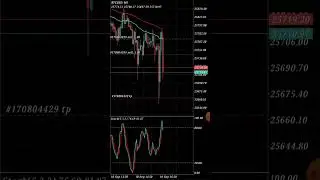 live🔴 FOREX TRADING 💲 300 usd profit