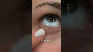 😱 БЮДЖЕТНЫЙ ШОК крем для кожи вокруг глаз 👁️ 