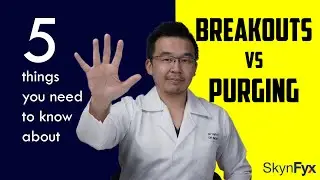 Breakout Vs Purging | 5 things to know