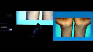 Dermatology in Africa: Emphasis on HIV related skin problems