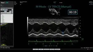 Auto LV vs LV Trace: M-Mode