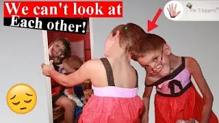 The Conjoined Twins Who Will Never Look At Each Other In The Eyes! 👁️👁️ ~ Body Bizarre!