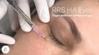 RRS HA eyes treatment l For puffy eyes & dark cirkles