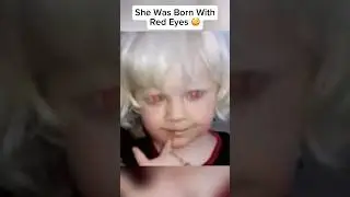 The Most Unusual Babies In The World 🤯