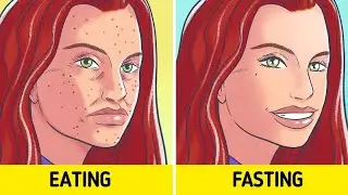 Benefits of Fasting in Hindi | उपवास और रोजे के फायदे | #fasting #benifits