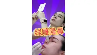 Get to Know Nose Thread Lifts: A Simple Guide for a Beautiful Nose
