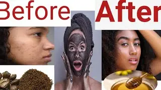 ለጠቆረ ፊት እና ሰውነት ምርጥ መላ