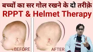 Flat Head Prevention and Treatment | बच्चे का सिर गोल कैसे करें | Plagiocephaly | Dr Md Noor Alam