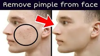 How to remove pimple on picsart | picsart best tutorial.
