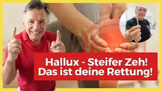 Steifer Zeh! Hallux Schmerzen - Du kannst nicht gehen? Dein Fuß schmerzt? Das ist deine Rettung!