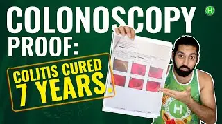 Colonoscopy Proof after 7 years