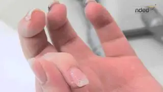 Do it yourself LED Gel Nails - Nail modeling self-made | nded.com