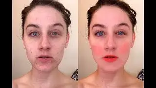 Как убрать прыщи в фотошоп