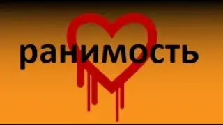 Ранимый человек.  Ранимое сердце. Гадалки и экстрасенсы пользуются добротой. Контролировать себя.