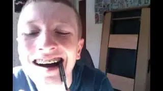 Broken Brace AGAIN!!!!!!!!!!!!!!!!!!!!!!!!!!!!!!!!!!!!!!!!!!!!!!!!!!!!!