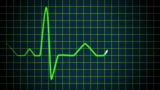 Cardiogram - Moho Pro 12 - ECG