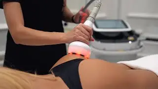Skinny Peach by Eagle Eye video production
